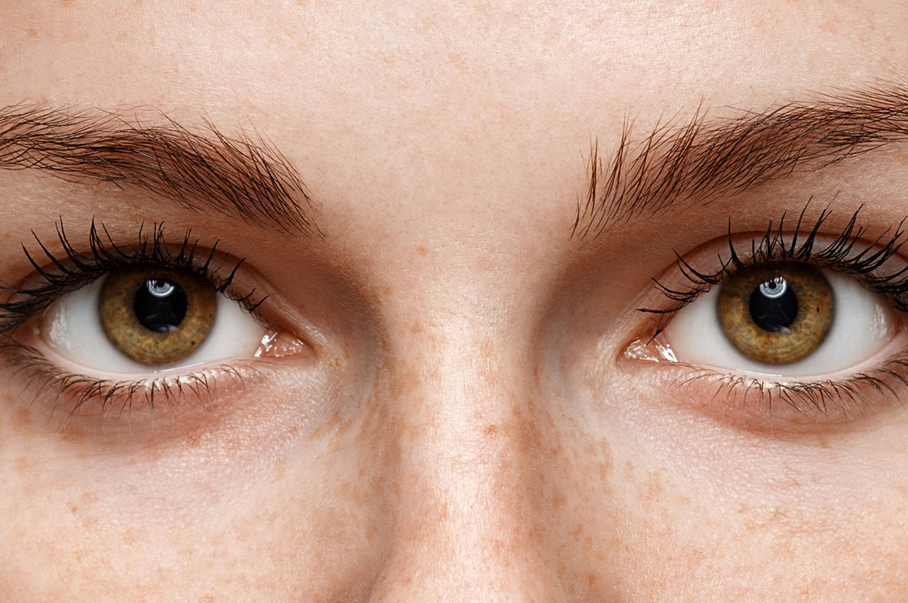 Poprawa wyglądu okolicy oka z zastosowaniem fibryny