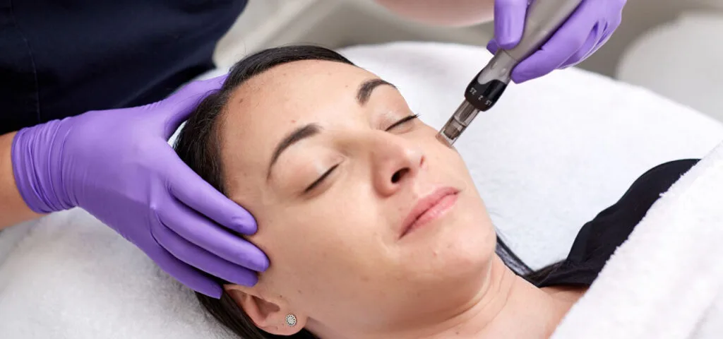 Stymulacja kolagenu Dermapenem