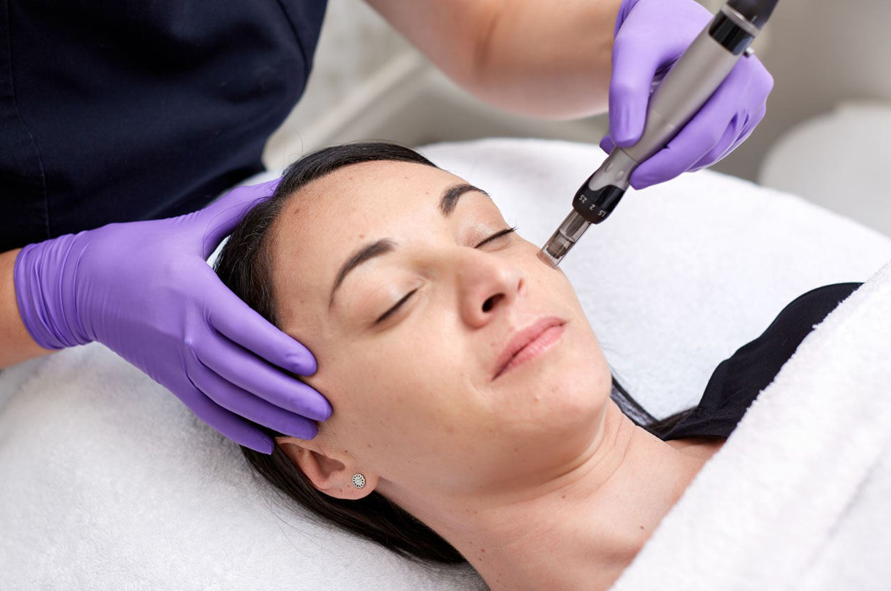 Stymulacja kolagenu Dermapenem