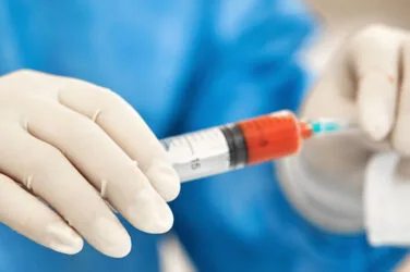 Zabieg lipotransferu - przeszczep własnej tkanki tłuszczowej w OK CLINIC Warszawa