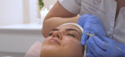 karboksyterapia