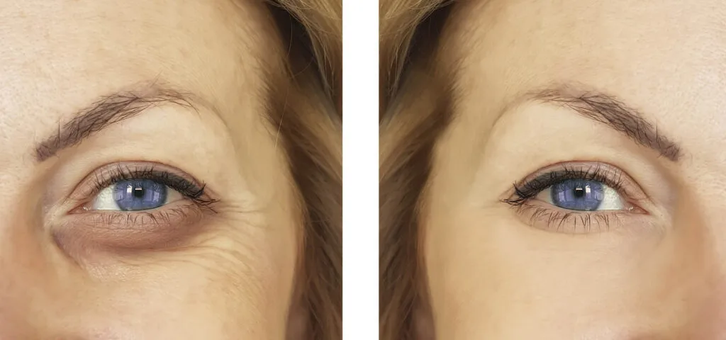 efekt nucleofill soft eyes