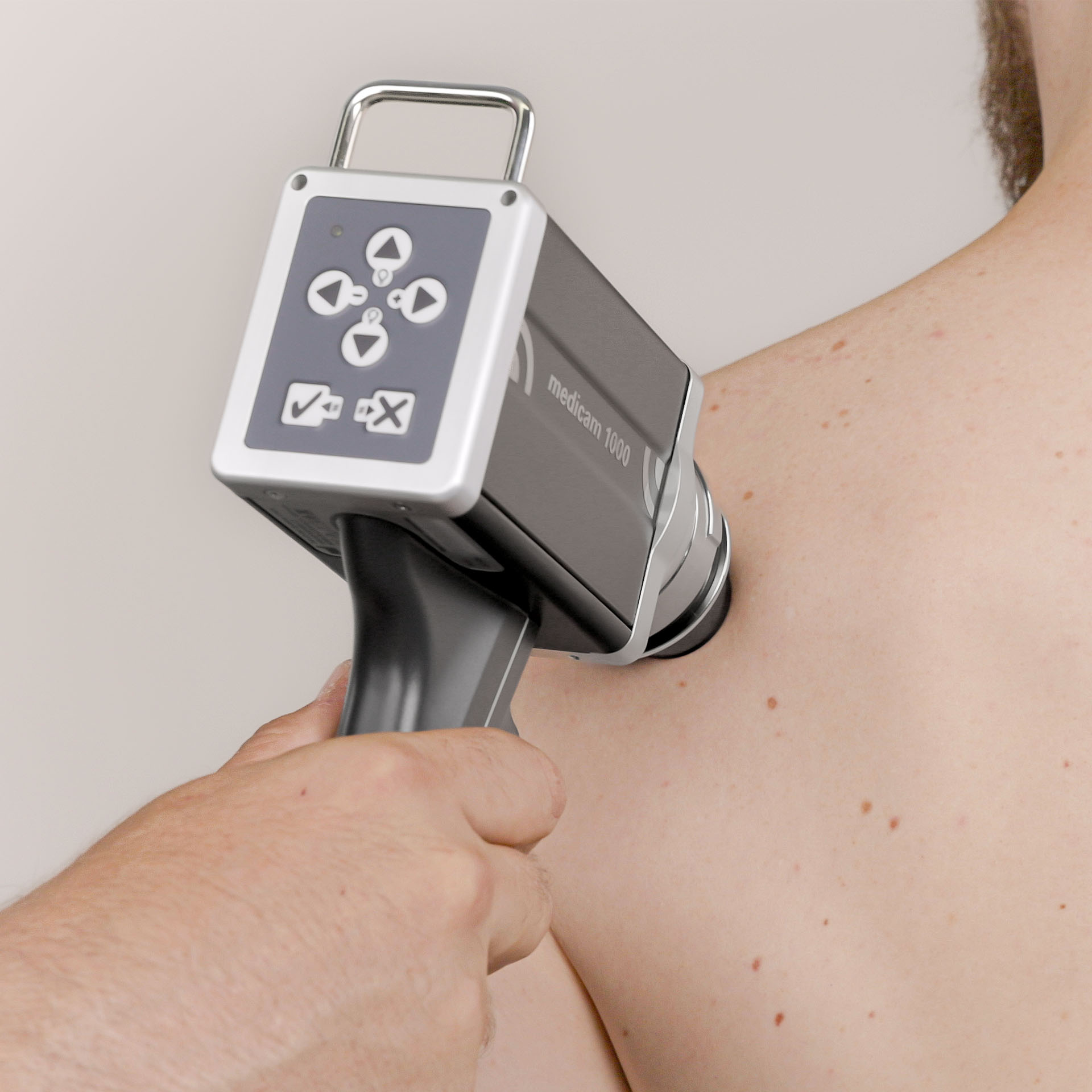 Wideodermatoskop FotoFinder w użyciu podczas badania skóry
