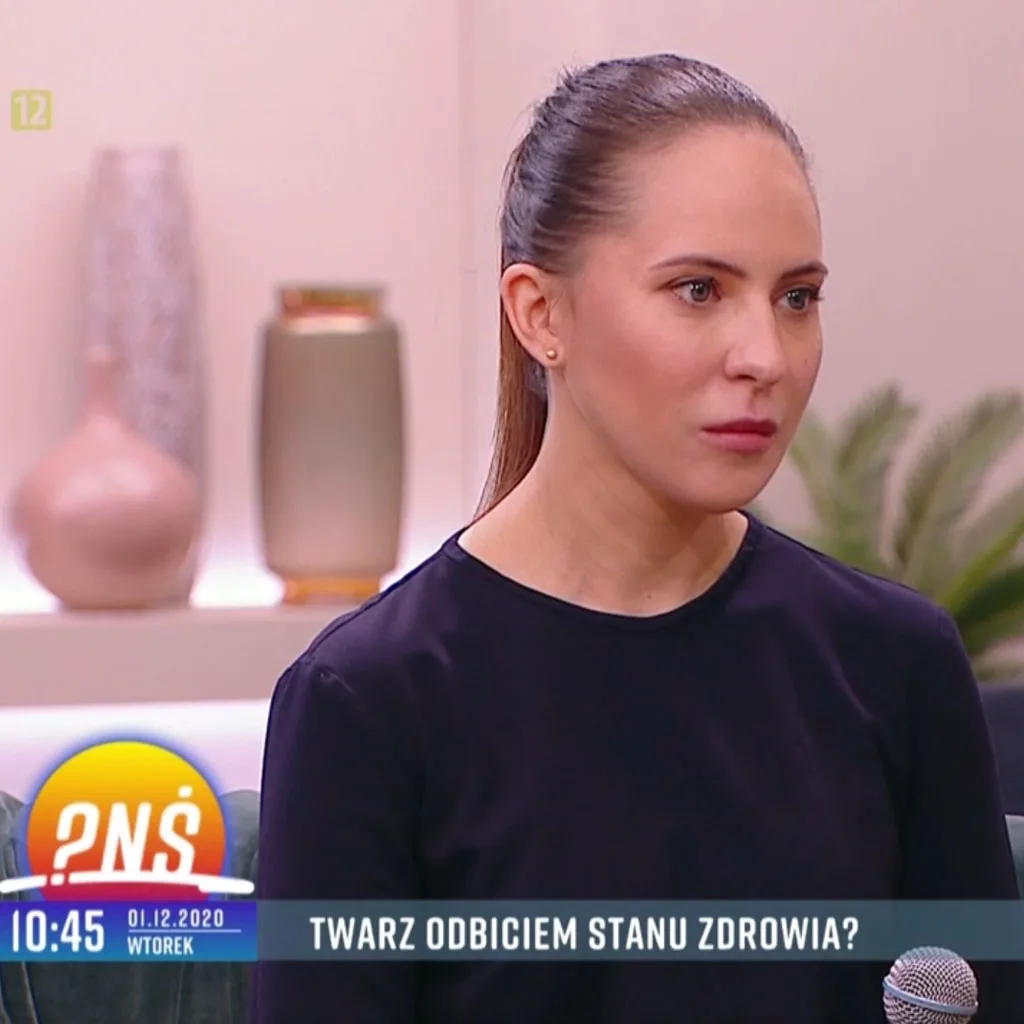 Twarz odbiciem stanu zdrowia - Pytanie na Śniadanie, TVP