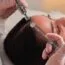 Mikronakłuwanie skóry głowy urządzeniem R.PEN podczas zabiegu Retix C Hairbooster (zdjęcie producenta)